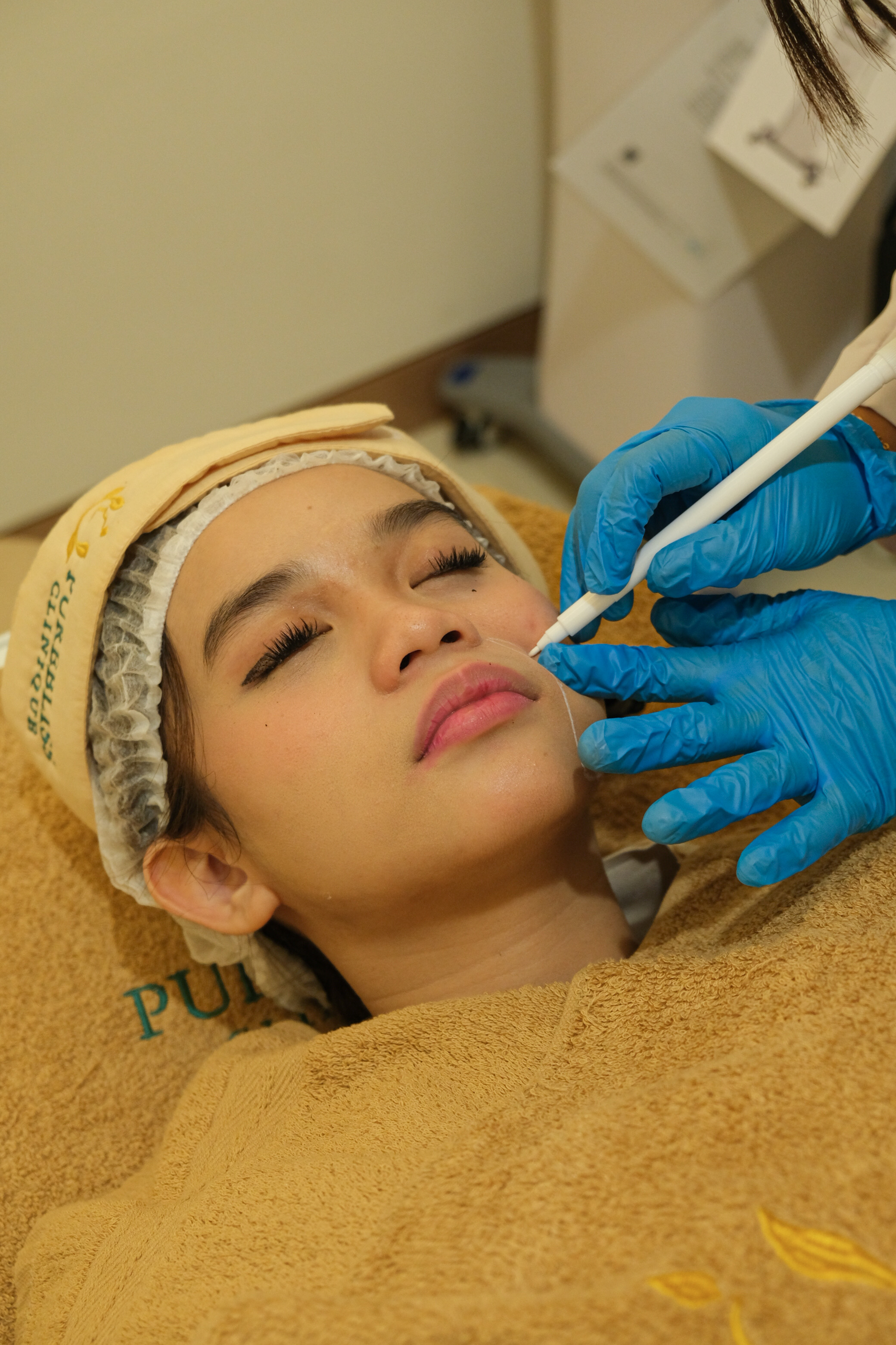 Face Contouring Injection, Filler & Thread Lift